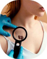 biopsia-dermatologica-2